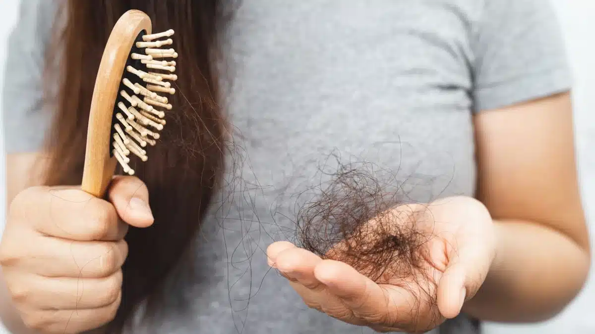 Why do I Lose Hair? 5 Major Causes of Hair Loss You Should Know